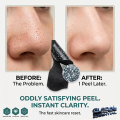Global Prime Essential nose blackhead remover pore strips for deep cleansing and visible impurities removal in 10 minutes.
