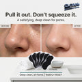 Global Prime Essential blackhead remover pore strips pulling out blackheads from nose for deep cleansing and visible results.