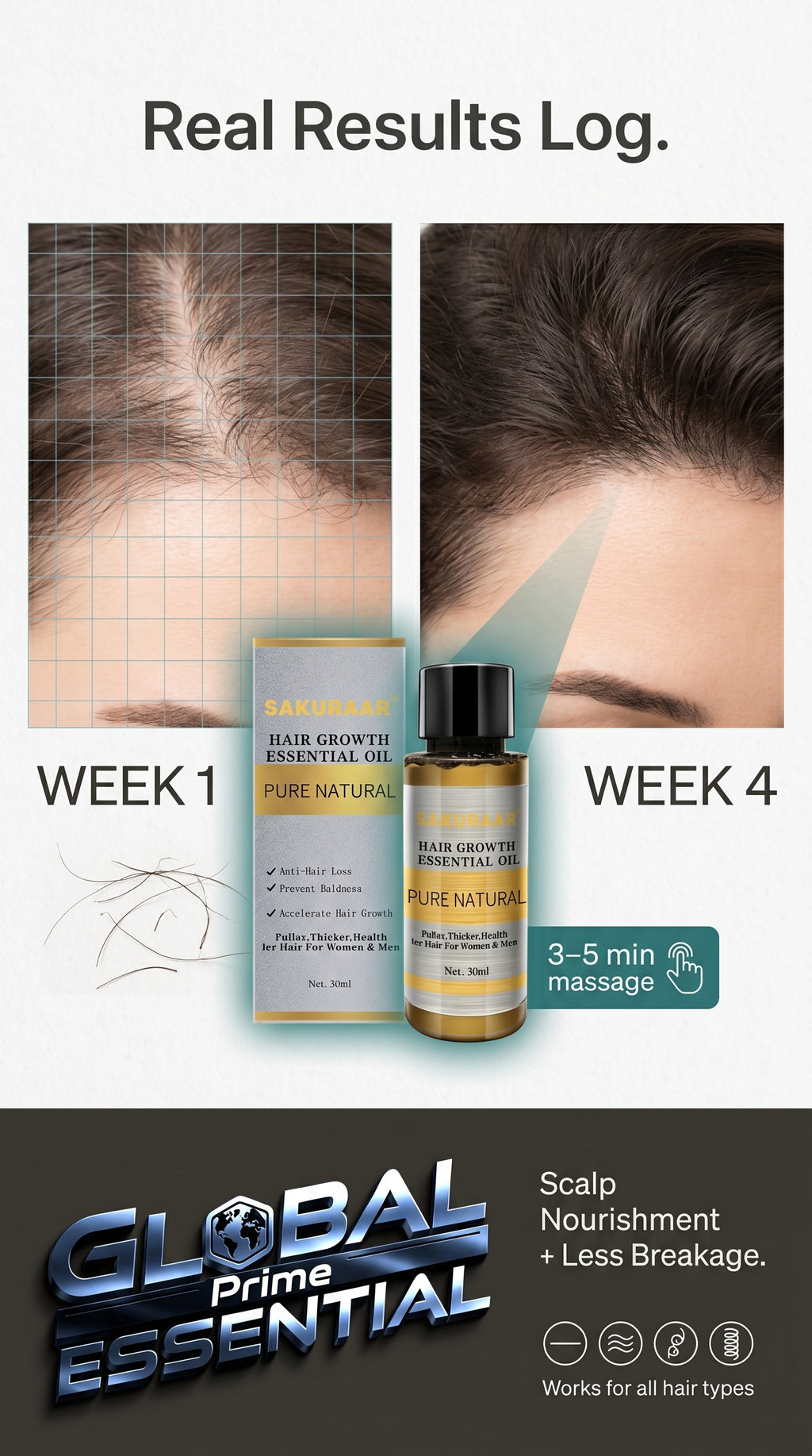 Global Prime Essential Hair Growth Oil nourishing scalp treatment showing thicker, fuller hair with fewer breakages in real results.