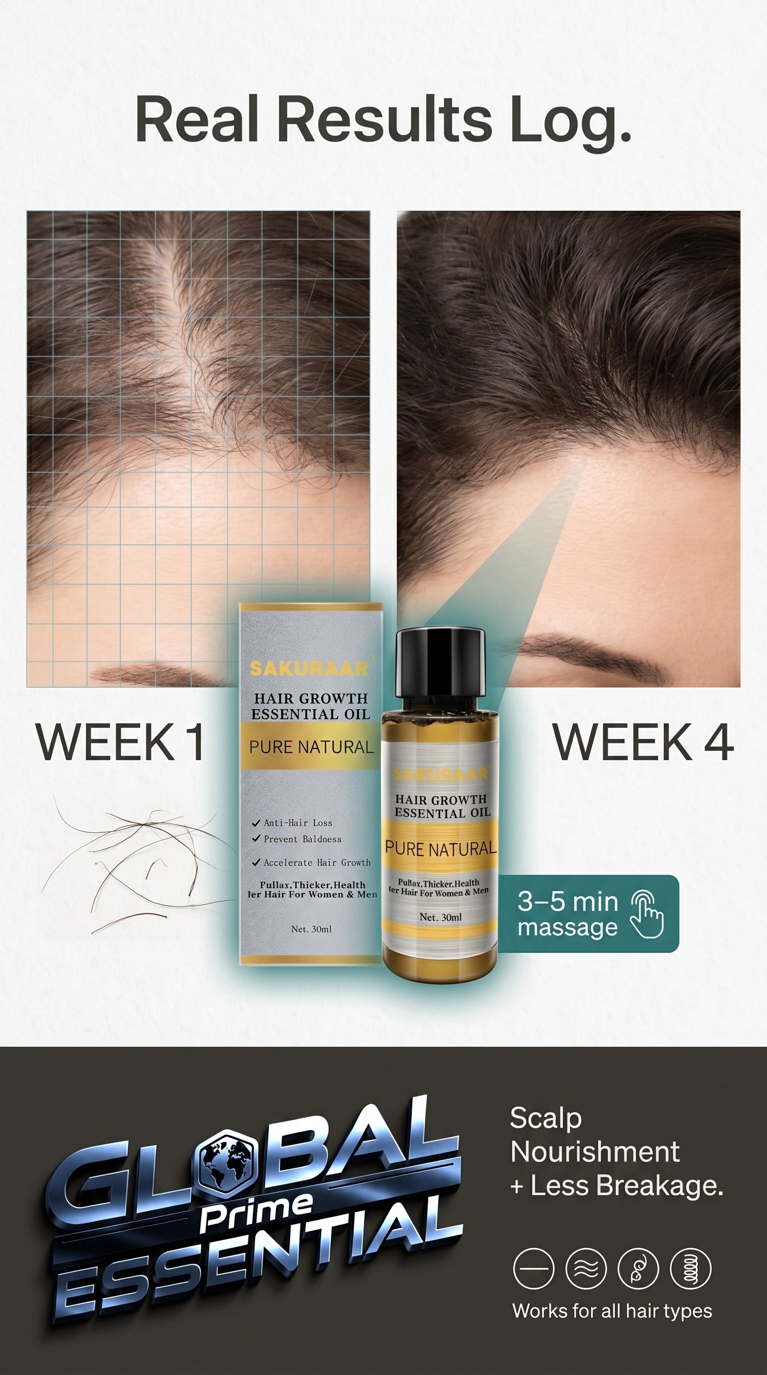 Global Prime Essential Hair Growth Oil nourishing scalp treatment showing thicker, fuller hair with fewer breakages in real results.