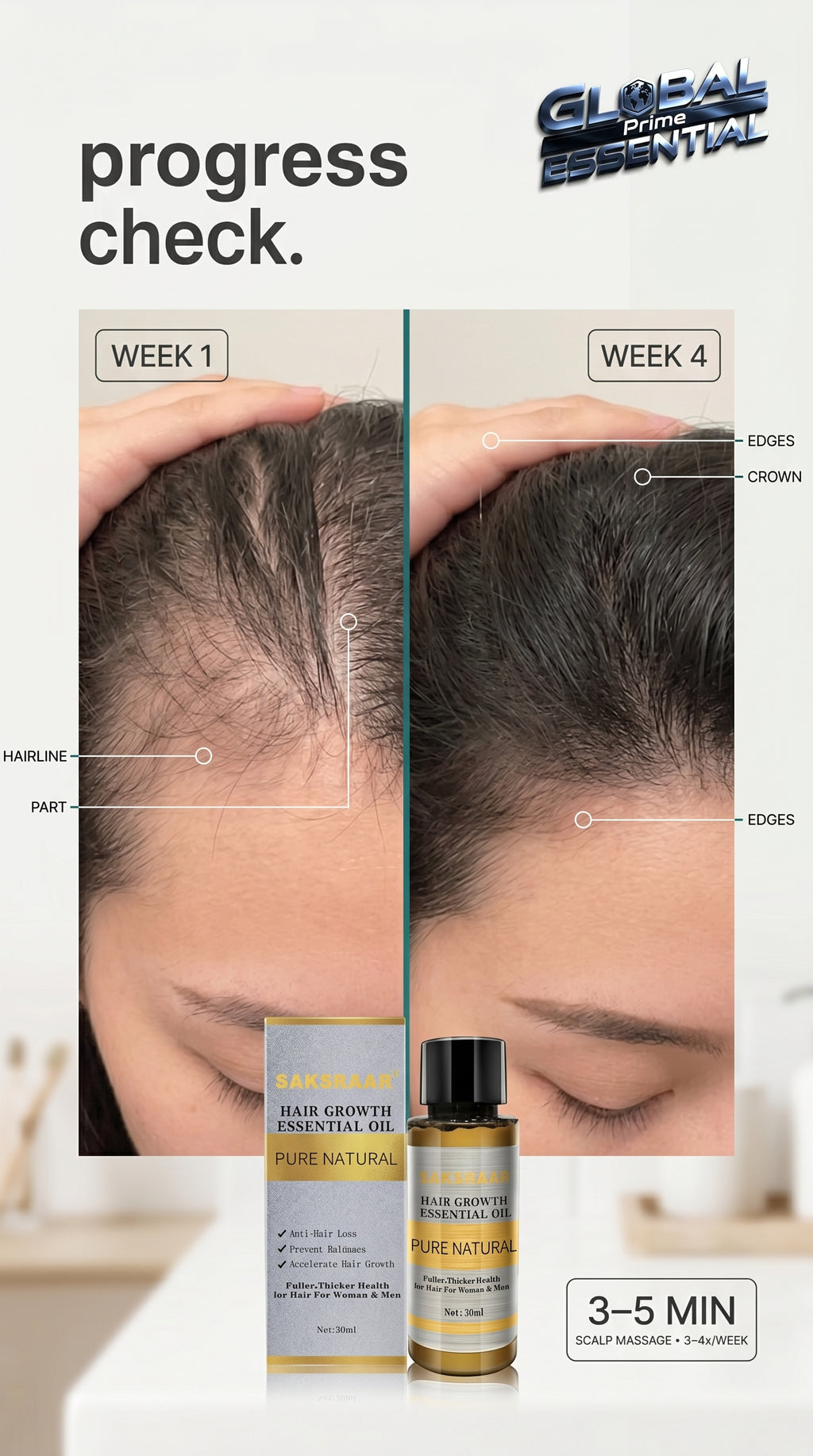 Global Prime Essential Hair Growth Oil bottle next to scalp treatment before and after images showing improved hair thickness over four weeks