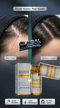 Global Prime Essential hair growth oil bottle and dropper for nourishing scalp treatment to promote thicker, fuller hair.